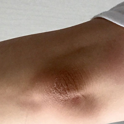 肌へのうるおい